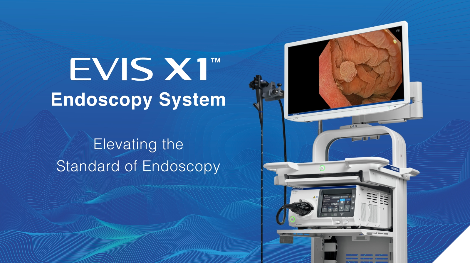 EVIS X1™ Endoscopy System: Elevating the Standard of Endoscopy